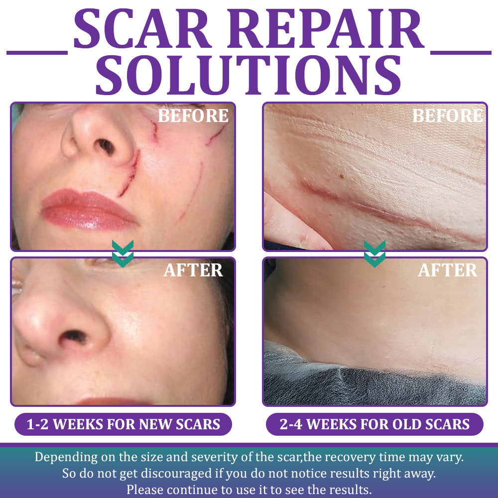🏷️ Official Store: Flysmus® ReGen Hyaluronic Acid Nano-Heal Microneedle Tape - 💝Treatment of old and new scars, reduction of surgical scars, stretch marks, keloids, acne, burns, warts, dermatomes and varicose veins