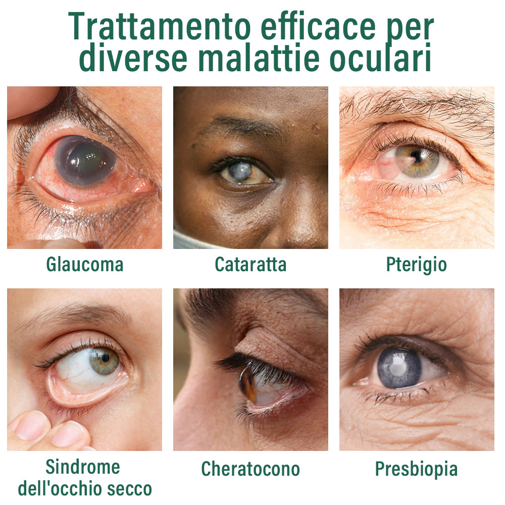 ✅ Ourlyard® Nano Siero per Gocce Oculari 👩⚕️Adatto per presbiopia, sindrome dell’occhio secco, glaucoma e cataratta