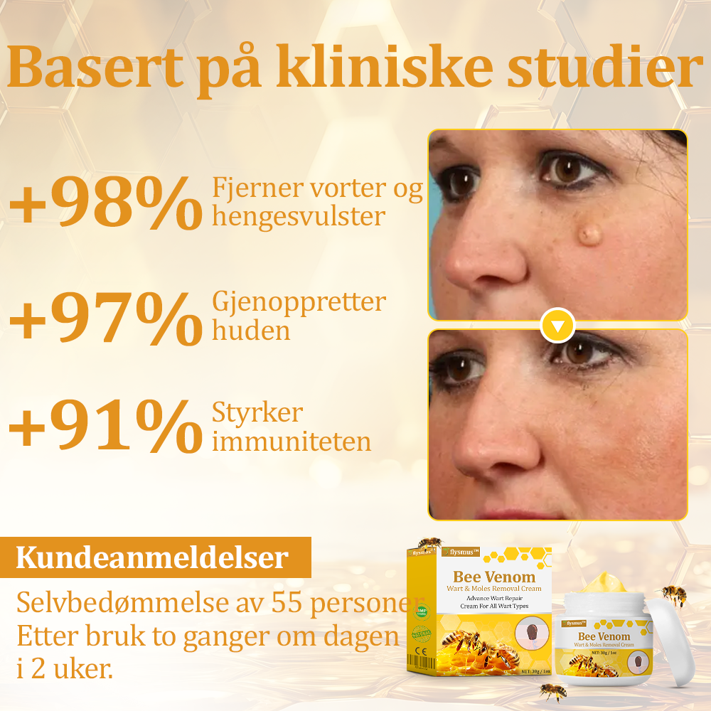 👨⚕️flysmus™ Cura Forte al veleno d'ape, Tratta verruche, escrescenze, infezioni e cicatrici, Leviga la pelle irregolare, Certificato dalla Società Italiana di Dermatologia (SIDeMaST) 🌟