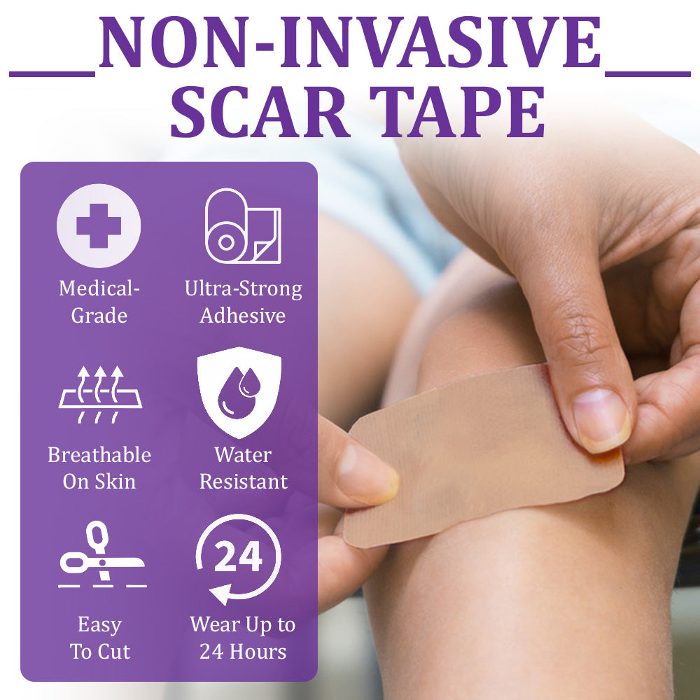 🏷️ Official Store: Flysmus® ReGen Hyaluronic Acid Nano-Heal Microneedle Tape - 💝Treatment of old and new scars, reduction of surgical scars, stretch marks, keloids, acne, burns, warts, dermatomes and varicose veins