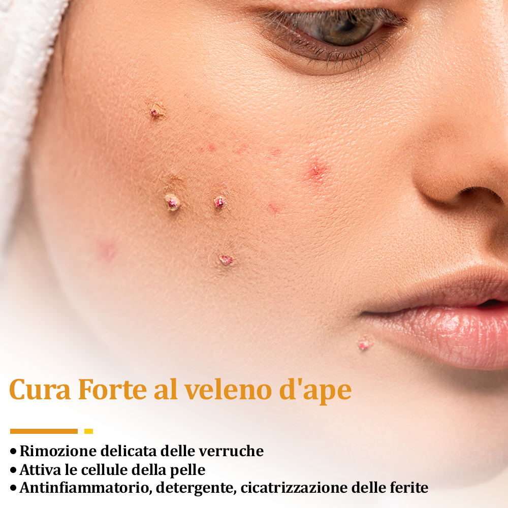 👨⚕️flysmus™ Cura Forte al veleno d'ape, Tratta verruche, escrescenze, infezioni e cicatrici, Leviga la pelle irregolare, Certificato dalla Società Italiana di Dermatologia (SIDeMaST) 🌟