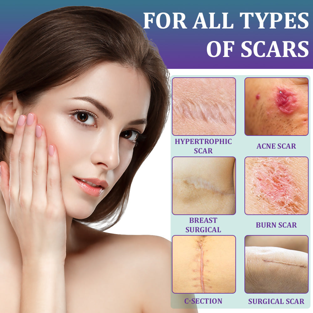 🏷️ Official Store: Flysmus® ReGen Hyaluronic Acid Nano-Heal Microneedle Tape - 💝Treatment of old and new scars, reduction of surgical scars, stretch marks, keloids, acne, burns, warts, dermatomes and varicose veins