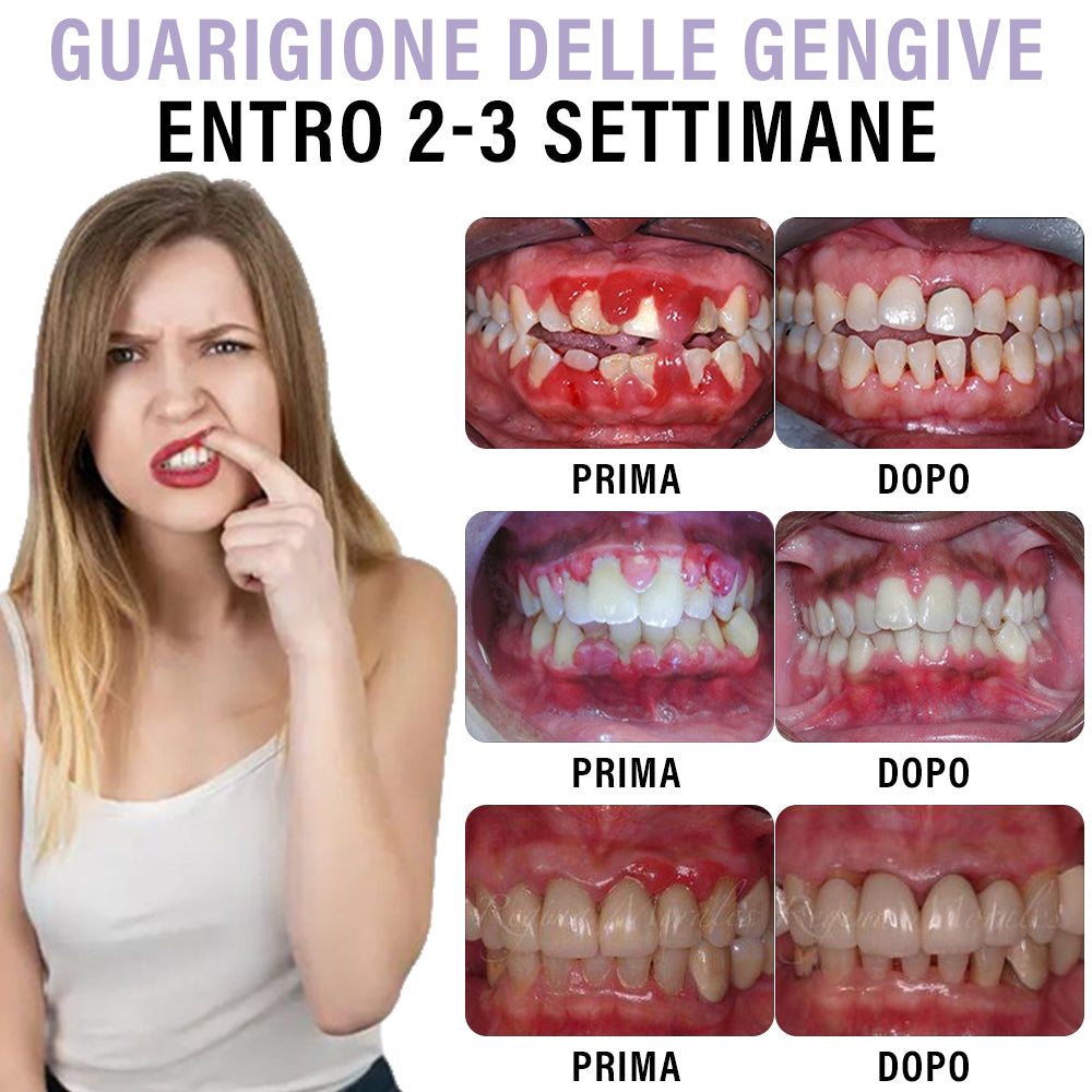 ✅ Prodotto e spedito dall'Italia | Ourlyard® Spray per la Cura Orale con Olio di Chiodi di Garofano (cura completa, trattamento efficace per tutti i problemi orali) 💛💛