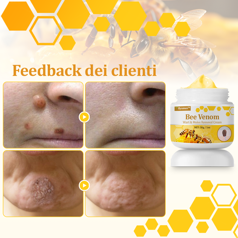 👨⚕️flysmus™ Cura Forte al veleno d'ape, Tratta verruche, escrescenze, infezioni e cicatrici, Leviga la pelle irregolare, Certificato dalla Società Italiana di Dermatologia (SIDeMaST) 🌟