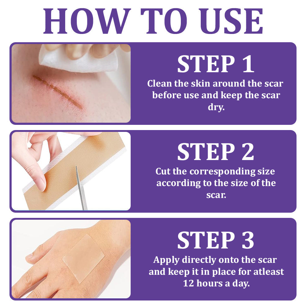 🏷️ Official Store: Flysmus® ReGen Hyaluronic Acid Nano-Heal Microneedle Tape - 💝Treatment of old and new scars, reduction of surgical scars, stretch marks, keloids, acne, burns, warts, dermatomes and varicose veins