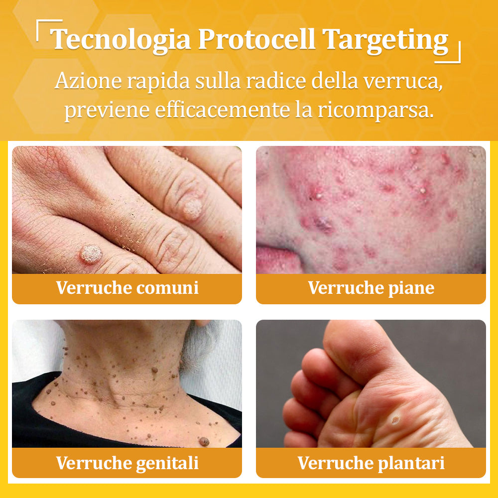 👩⚕️flysmus® Crema al Veleno d’Ape – Testata da dermatologi. Efficace contro verruche, noduli, lesioni, infezioni e cicatrici.