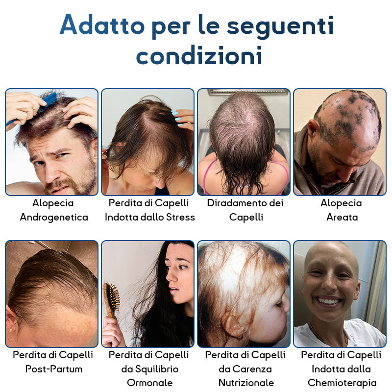 ✅Sviluppato da tricologi: Rolimey® Attiva & Rigenera Cellule Staminali Roll-on – Ferma immediatamente la caduta dei capelli e promuove una vera ricrescita (🔥Fino all'80% di sconto)