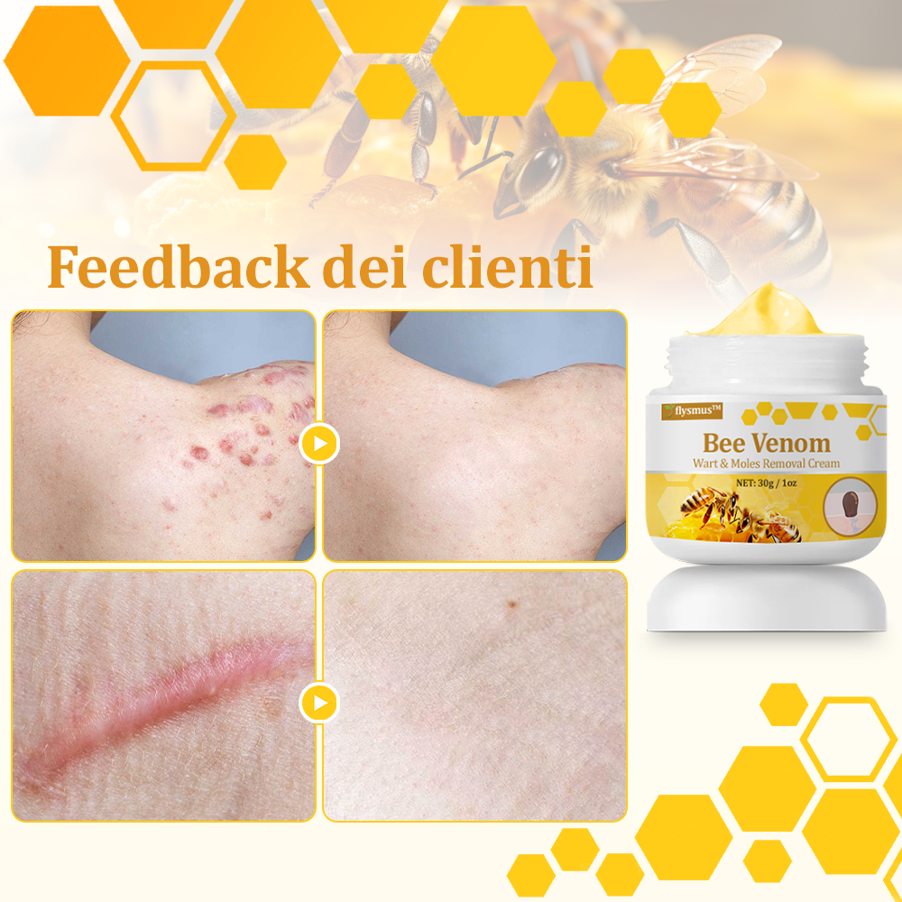 👨⚕️flysmus™ Cura Forte al veleno d'ape, Tratta verruche, escrescenze, infezioni e cicatrici, Leviga la pelle irregolare, Certificato dalla Società Italiana di Dermatologia (SIDeMaST) 🌟