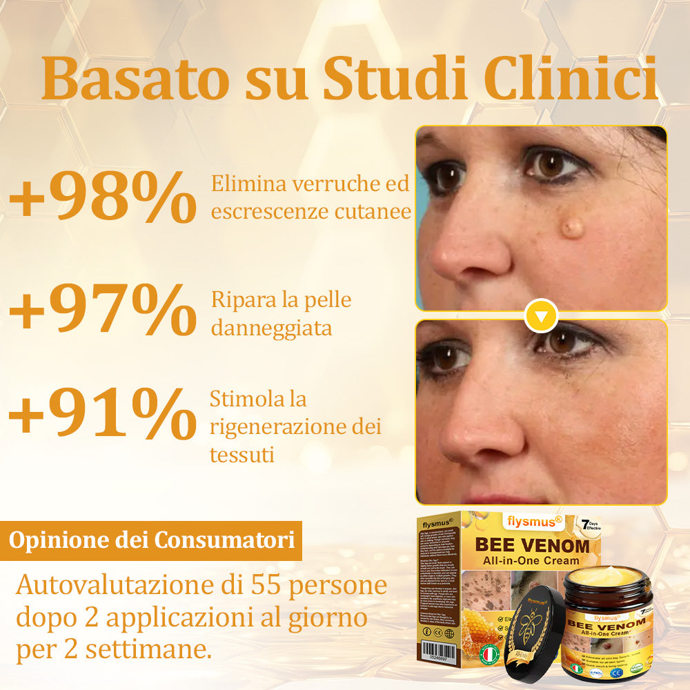 👩⚕️flysmus® Crema al Veleno d’Ape – Testata da dermatologi. Efficace contro verruche, noduli, lesioni, infezioni e cicatrici.