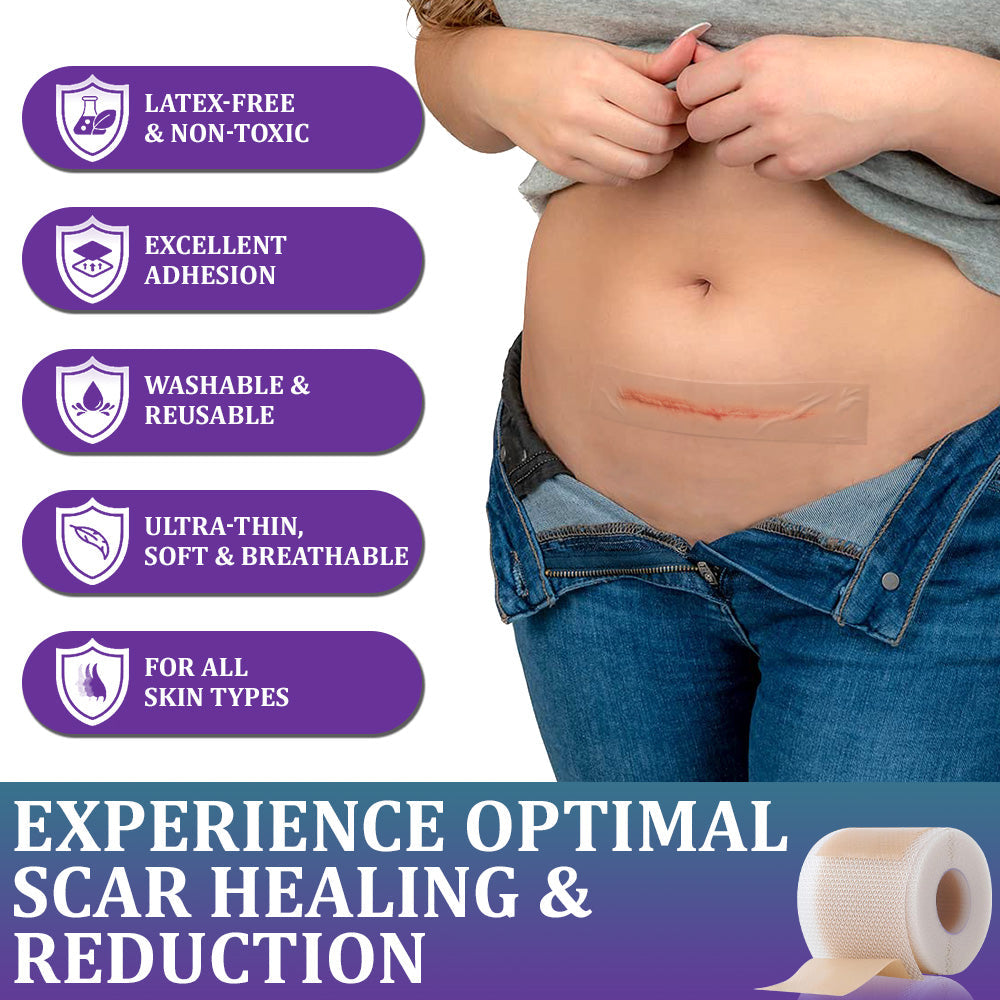 🏷️ Official Store: Flysmus® ReGen Hyaluronic Acid Nano-Heal Microneedle Tape - 💝Treatment of old and new scars, reduction of surgical scars, stretch marks, keloids, acne, burns, warts, dermatomes and varicose veins