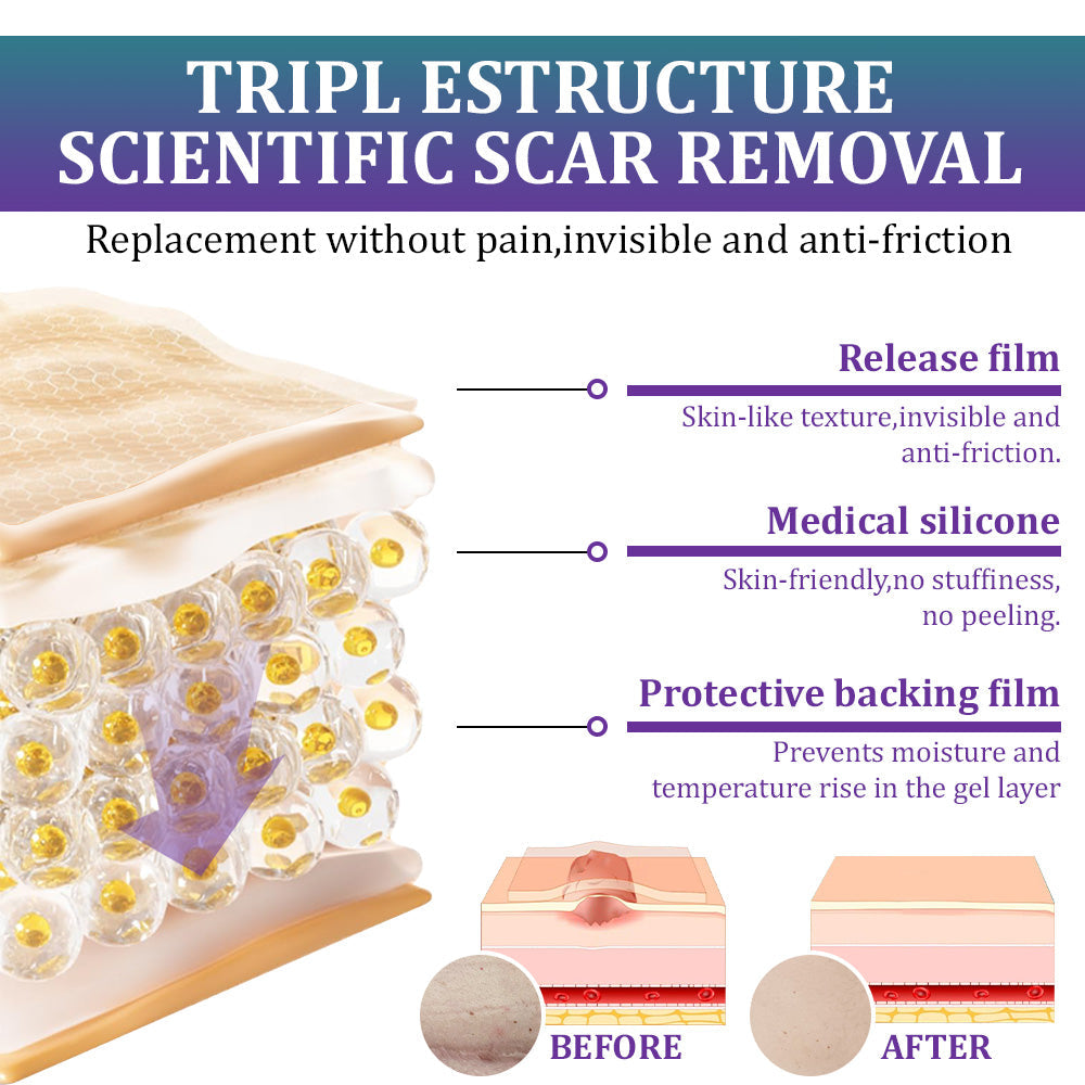🏷️ Official Store: Flysmus® ReGen Hyaluronic Acid Nano-Heal Microneedle Tape - 💝Treatment of old and new scars, reduction of surgical scars, stretch marks, keloids, acne, burns, warts, dermatomes and varicose veins