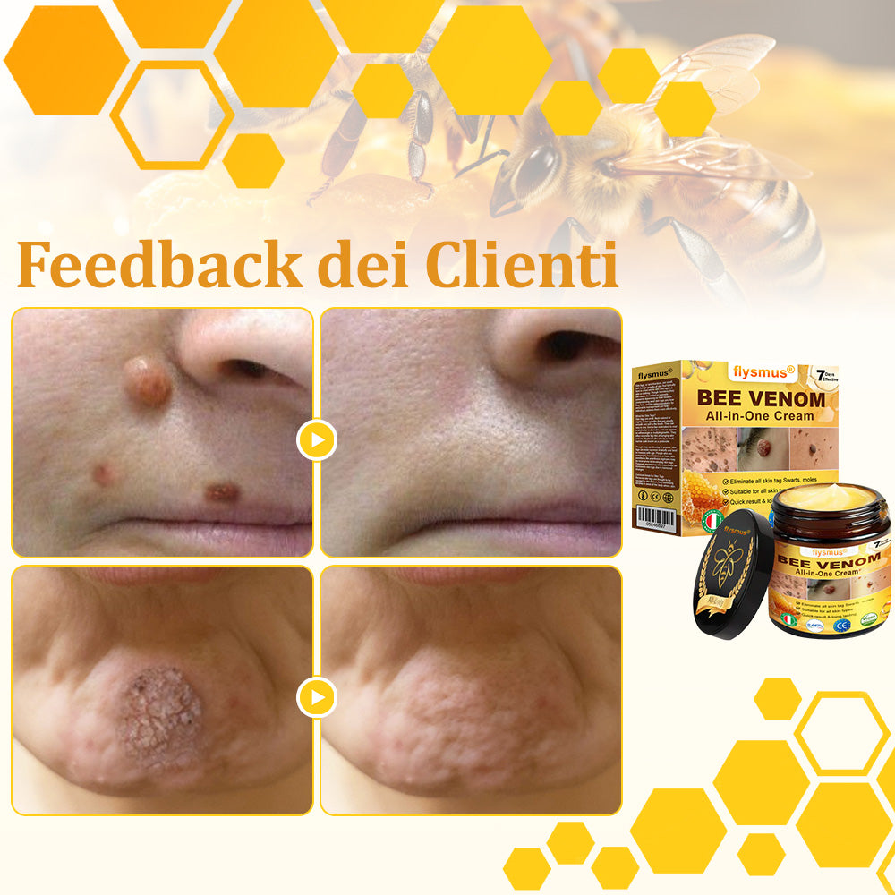 👩⚕️flysmus® Crema al Veleno d’Ape – Testata da dermatologi. Efficace contro verruche, noduli, lesioni, infezioni e cicatrici.