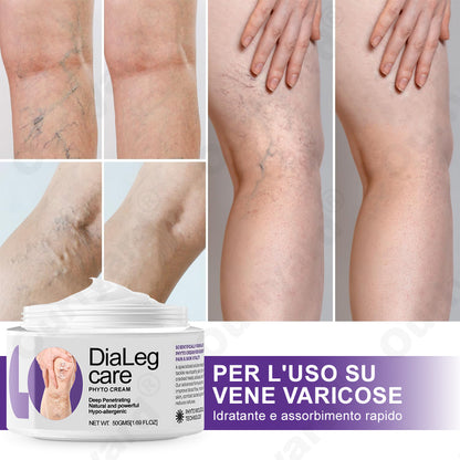 ✅ 𝐀𝐩𝐩𝐫𝐨𝐯𝐚𝐭𝐚 𝐝𝐚𝐥 𝐒𝐒𝐍👨‍⚕️ 𝐎𝐮𝐫𝐥𝐲𝐚𝐫𝐝® 𝐃𝐢𝐚𝐋𝐞𝐠 𝐂𝐚𝐫𝐞 – 𝐂𝐫𝐞𝐦𝐚 𝐅𝐢𝐭𝐨𝐭𝐞𝐫𝐚𝐩𝐢𝐜𝐚 𝐌𝐞𝐝𝐢𝐜𝐚 - Aiuta a trattare vene varicose, gambe gonfie, crampi e dolori persistenti.