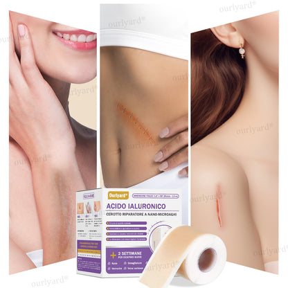 ✅ Negozio Ufficiale | Ourlyard® Nastro Riparatore a Microaghi con Acido Ialuronico🏥(Trattamento di cicatrici vecchie e nuove, riduzione di cicatrici chirurgiche, smagliature, cheloidi, acne, ustioni, verruche, dermatomi e vene varicose)