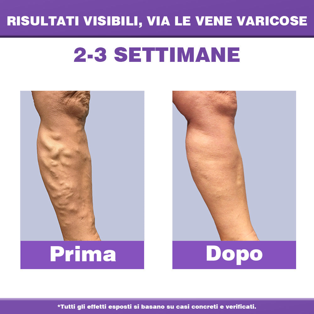 ✅ 𝐀𝐩𝐩𝐫𝐨𝐯𝐚𝐭𝐚 𝐝𝐚𝐥 𝐒𝐒𝐍👨‍⚕️ 𝐎𝐮𝐫𝐥𝐲𝐚𝐫𝐝® 𝐃𝐢𝐚𝐋𝐞𝐠 𝐂𝐚𝐫𝐞 – 𝐂𝐫𝐞𝐦𝐚 𝐅𝐢𝐭𝐨𝐭𝐞𝐫𝐚𝐩𝐢𝐜𝐚 𝐌𝐞𝐝𝐢𝐜𝐚 - Aiuta a trattare vene varicose, gambe gonfie, crampi e dolori persistenti.