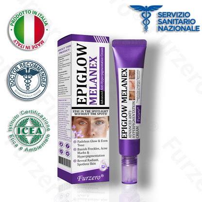 🌹𝐒𝐒𝐍 𝐀𝐩𝐩𝐫𝐨𝐯𝐚𝐭𝐨 | 𝐅𝐮𝐫𝐳𝐞𝐫𝐨® 𝐄𝐏𝐈𝐆𝐋𝐎𝐖 𝐌𝐞𝐥𝐚𝐧𝐄𝐗 𝐂𝐫𝐞𝐦𝐚 𝐀𝐯𝐚𝐧𝐳𝐚𝐭𝐚 𝐀𝐧𝐭𝐢-𝐈𝐩𝐞𝐫𝐩𝐢𝐠𝐦𝐞𝐧𝐭𝐚𝐳𝐢𝐨𝐧𝐞