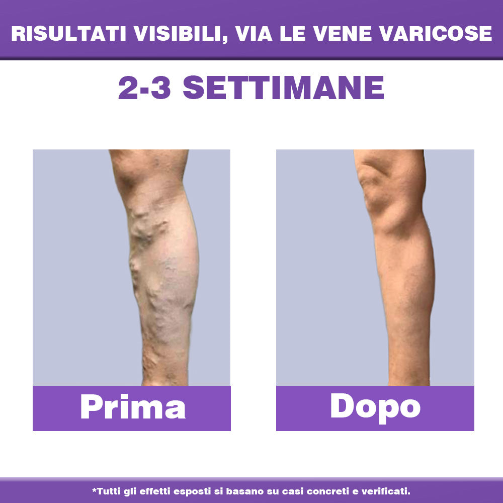 ✅ 𝐀𝐩𝐩𝐫𝐨𝐯𝐚𝐭𝐚 𝐝𝐚𝐥 𝐒𝐒𝐍👨‍⚕️ 𝐎𝐮𝐫𝐥𝐲𝐚𝐫𝐝® 𝐃𝐢𝐚𝐋𝐞𝐠 𝐂𝐚𝐫𝐞 – 𝐂𝐫𝐞𝐦𝐚 𝐅𝐢𝐭𝐨𝐭𝐞𝐫𝐚𝐩𝐢𝐜𝐚 𝐌𝐞𝐝𝐢𝐜𝐚 - Aiuta a trattare vene varicose, gambe gonfie, crampi e dolori persistenti.