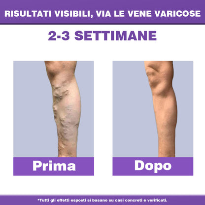 ✅ 𝐀𝐩𝐩𝐫𝐨𝐯𝐚𝐭𝐚 𝐝𝐚𝐥 𝐒𝐒𝐍👨‍⚕️ 𝐎𝐮𝐫𝐥𝐲𝐚𝐫𝐝® 𝐃𝐢𝐚𝐋𝐞𝐠 𝐂𝐚𝐫𝐞 – 𝐂𝐫𝐞𝐦𝐚 𝐅𝐢𝐭𝐨𝐭𝐞𝐫𝐚𝐩𝐢𝐜𝐚 𝐌𝐞𝐝𝐢𝐜𝐚 - Aiuta a trattare vene varicose, gambe gonfie, crampi e dolori persistenti.