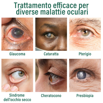 ✅ Ourlyard® Nano Siero per Gocce Oculari 👩‍⚕️Adatto per presbiopia, sindrome dell’occhio secco, glaucoma e cataratta