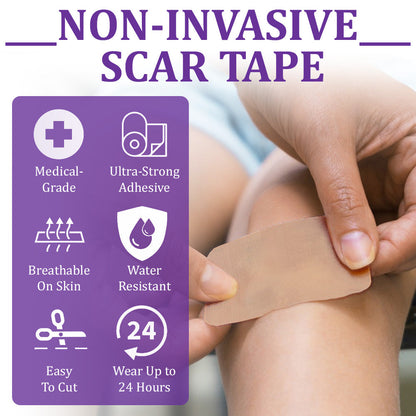 🏷️ Official Store: Flysmus® ReGen Hyaluronic Acid Nano-Heal Microneedle Tape - 💝Treatment of old and new scars, reduction of surgical scars, stretch marks, keloids, acne, burns, warts, dermatomes and varicose veins
