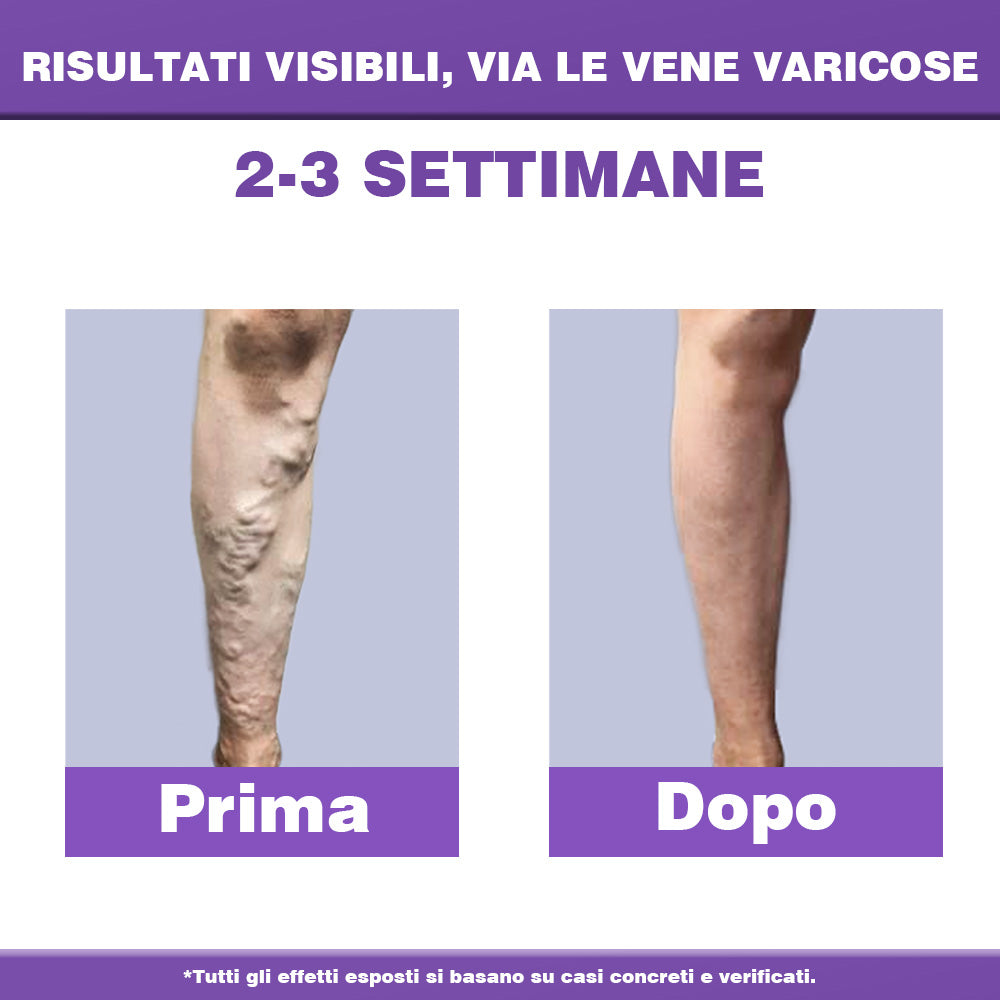 ✅ 𝐀𝐩𝐩𝐫𝐨𝐯𝐚𝐭𝐚 𝐝𝐚𝐥 𝐒𝐒𝐍👨‍⚕️ 𝐎𝐮𝐫𝐥𝐲𝐚𝐫𝐝® 𝐃𝐢𝐚𝐋𝐞𝐠 𝐂𝐚𝐫𝐞 – 𝐂𝐫𝐞𝐦𝐚 𝐅𝐢𝐭𝐨𝐭𝐞𝐫𝐚𝐩𝐢𝐜𝐚 𝐌𝐞𝐝𝐢𝐜𝐚 - Aiuta a trattare vene varicose, gambe gonfie, crampi e dolori persistenti.