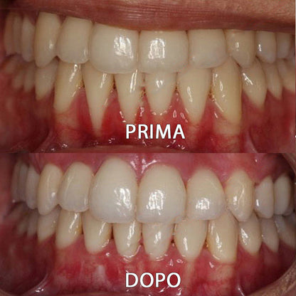 ✅👨🏻‍⚕️Negozio ufficiale | Ourlyard® Polvere minerale per la salute dei denti👨🏻‍⚕️Ottieni la certificazione Ottenuto la certificazione dell'Agenzia Italiana del Farmaco (AIFA)