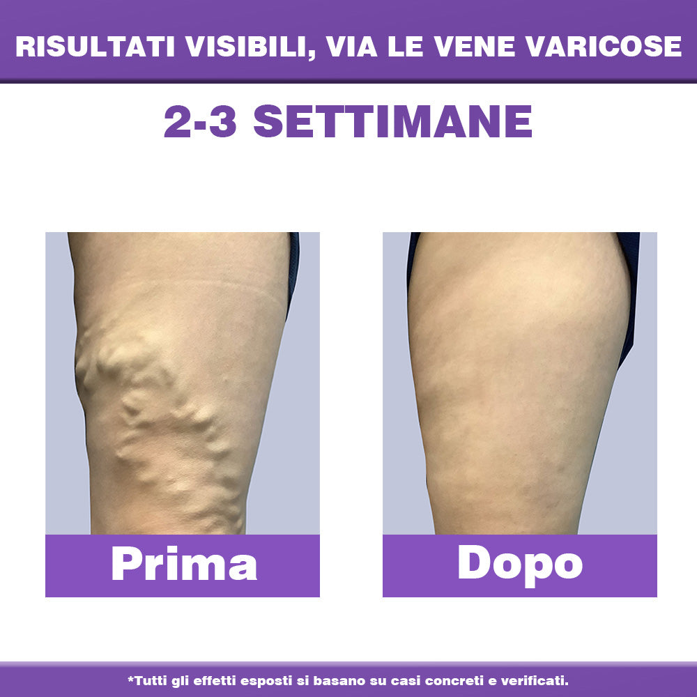 ✅ 𝐀𝐩𝐩𝐫𝐨𝐯𝐚𝐭𝐚 𝐝𝐚𝐥 𝐒𝐒𝐍👨‍⚕️ 𝐎𝐮𝐫𝐥𝐲𝐚𝐫𝐝® 𝐃𝐢𝐚𝐋𝐞𝐠 𝐂𝐚𝐫𝐞 – 𝐂𝐫𝐞𝐦𝐚 𝐅𝐢𝐭𝐨𝐭𝐞𝐫𝐚𝐩𝐢𝐜𝐚 𝐌𝐞𝐝𝐢𝐜𝐚 - Aiuta a trattare vene varicose, gambe gonfie, crampi e dolori persistenti.