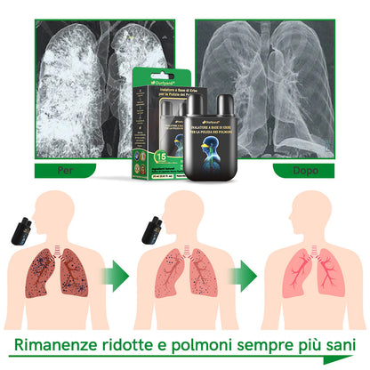 ✅Negozio Ufficiale: Ourlyard™ Inalatore a Base di Erbe per la Pulizia dei Polmoni