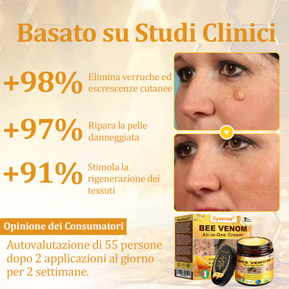 👨‍⚕️flysmus® Crema al Veleno d’Ape – Testata da dermatologi. Efficace contro verruche, noduli, lesioni, infezioni e cicatrici.