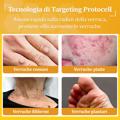 👨‍⚕️flysmus™ Cura Forte al veleno d'ape, Tratta verruche, escrescenze, infezioni e cicatrici, Leviga la pelle irregolare, Certificato dalla Società Italiana di Dermatologia (SIDeMaST) 🌟