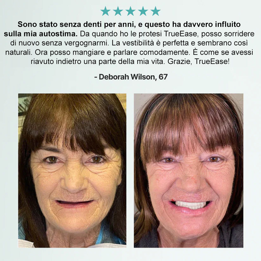 🦷𝗕𝗶𝗸𝗲𝗻𝗱𝗮®  𝗦𝗲𝘁 𝗔𝘃𝗮𝗻𝘇𝗮𝘁𝗼 𝗱𝗶 𝗣𝗿𝗼𝘁𝗲𝘀𝗶 𝗣𝗲𝗿𝘀𝗼𝗻𝗮𝗹𝗶𝘇𝘇𝗮𝘁𝗲 𝗖𝗼𝗺𝗽𝗹𝗲𝘁𝗲 (✅ Protesi con comfort clinicamente comprovato — Fidate da oltre 8.000 utenti italiani per un comfort tutto il giorno.)