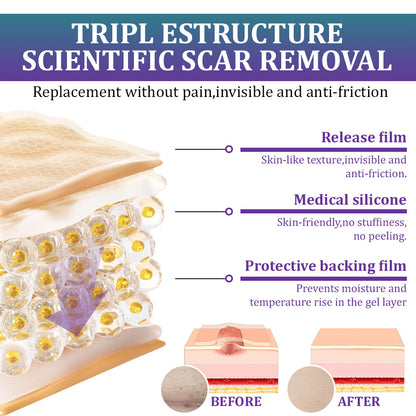 🏷️ Official Store: Flysmus® ReGen Hyaluronic Acid Nano-Heal Microneedle Tape - 💝Treatment of old and new scars, reduction of surgical scars, stretch marks, keloids, acne, burns, warts, dermatomes and varicose veins