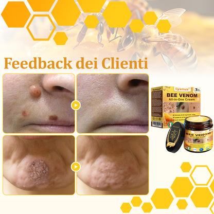 👨‍⚕️flysmus® Crema al Veleno d’Ape – Testata da dermatologi. Efficace contro verruche, noduli, lesioni, infezioni e cicatrici.