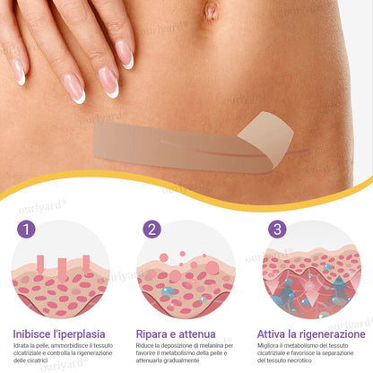 ✅ Negozio Ufficiale | Ourlyard® Nastro Riparatore a Microaghi con Acido Ialuronico🏥(Trattamento di cicatrici vecchie e nuove, riduzione di cicatrici chirurgiche, smagliature, cheloidi, acne, ustioni, verruche, dermatomi e vene varicose)